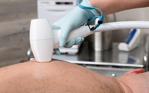 Diolaze Laser Hair Removal