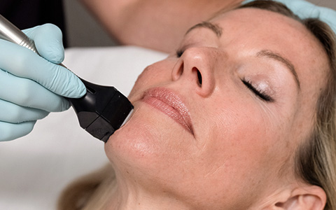 Forma Skin Tightening