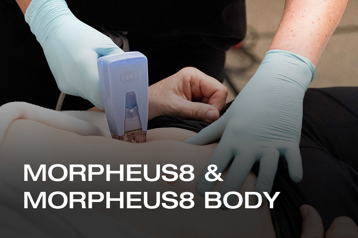 Morpheus8 & Morpheus8 BODY