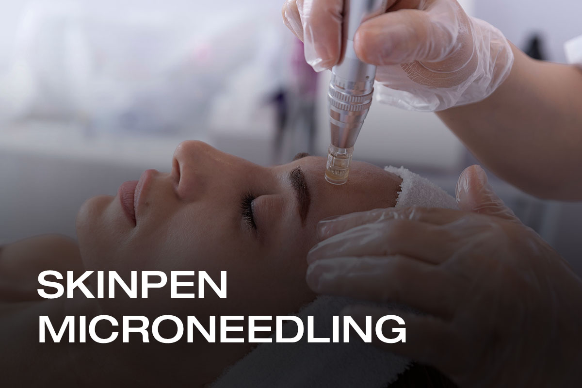 Microneedling